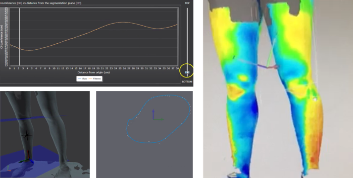 3D measurment of legs